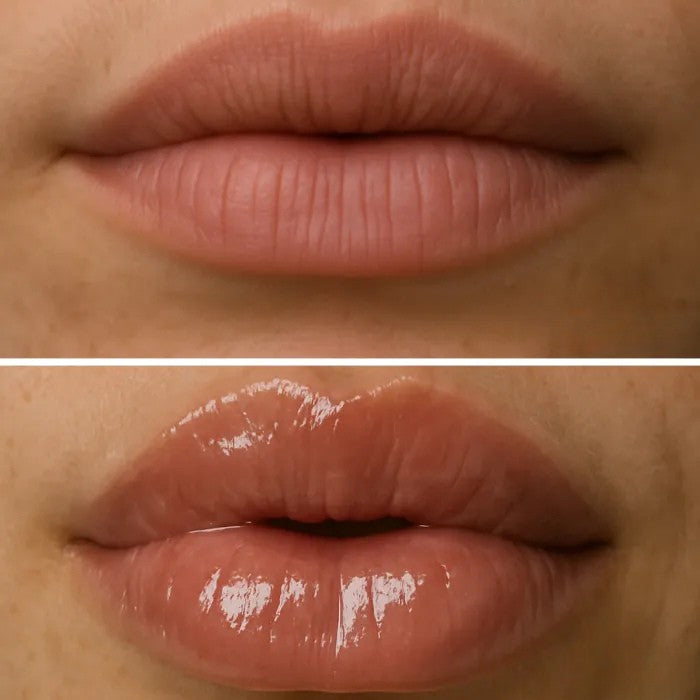 ממלא שפתיים טבעי - LIVIA